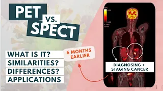 PET vs SPECT The basics Updated