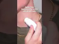 We all get them HOW TO COVER A HICKEY
