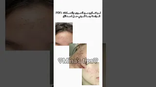 نزع لحبوب واثارها اكسبلور بنات بدون موسيقى تجميل نصائح للبنات عنايه بالبشره Fyp 