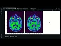 3 1 - Bias Field visualization SimpleITK