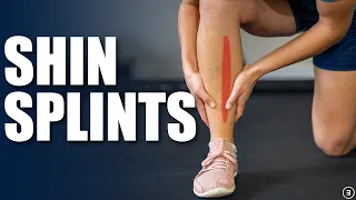 Download Shin Splints | Medial Tibial Stress Syndrome (Exercises, Rehab, Strengthening) MP3