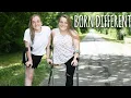 The Twins Who Used To Share One Body BORN DIFFERENT