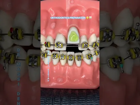 ORTHODONTICS PREPARATION 😬🦷