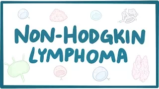 Non Hodgkin Lymphoma Causes Symptoms Diagnosis Treatment Pathology  Non Hodgkin Lymphoma Causes Symptoms Diagnosis Treatment Pathology