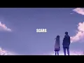 Download Lagu Keenan Te - Scars (lyrics)