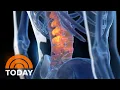 New therapy aims to cure back pain without drugs surgery