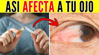 10 HÁBITOS Que Empeoran Tu CARNOSIDAD Ocular (Y No Lo Sabías)