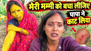 पापा ने काट लिया मम्मी को हो गया इन्फेक्शन 😭