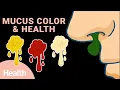 What Snot Says About Your Health Deep Dives Health