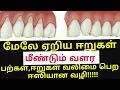 Lagu ஈறுகள் மேலே ஏறி அசிங்கமாக உள்ளதா! Receding gums home remedy