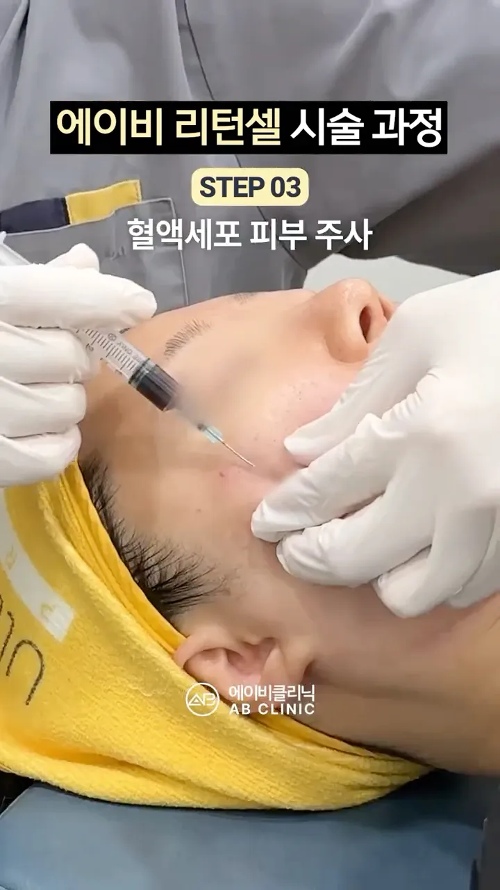 혈액세포 시술 과정 공개!
