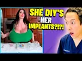 The LARGEST Implants in US EXTREME Bodies Explained
