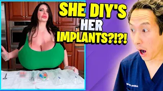 the largest implants in us extreme bodies explained
