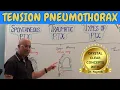 Tension pneumothorax Causes Clinical Correlations Emergency Treatment