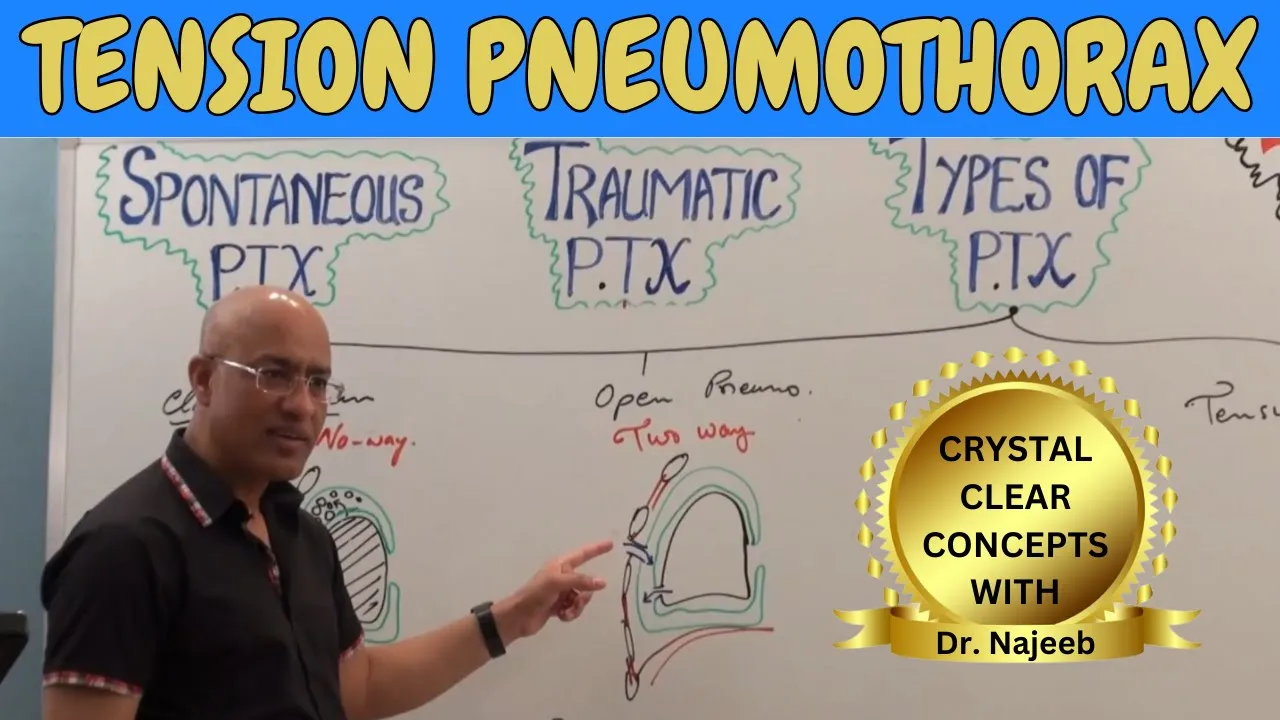Tension pneumothorax | Causes, Clinical Correlations | Emergency Treatment🩺
