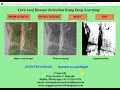 Corn Leaf Disease Detection Using Deep Learning Python Project Source Code Plant Disease Detect