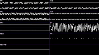 anesthesia ym2612 sn76489 