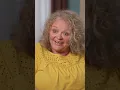 She Lost Her Fat Roll On Her Forehead