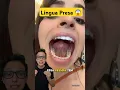 Download Lagu Língua Presa 😱 #medicina #medico #enfermagem #fonoaudiólogo Freio da Língua Frenectomia Frenotomia