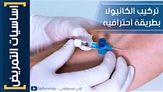 اساسيات التمريض 12 إزاي تركب الكانيولا الطرفية بطريقة احترافية I V Cannulation Procedure 