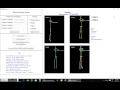 Kinect Server Application - Skeleton example 2