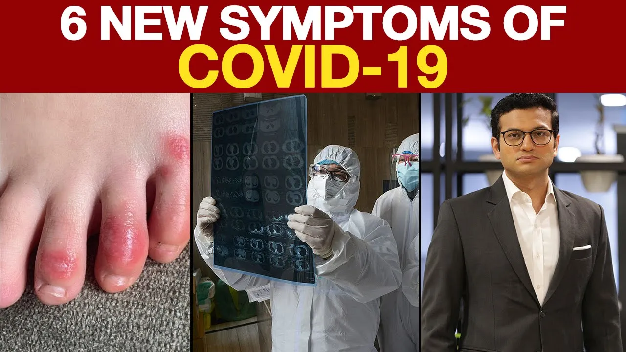 Long Covid: When coronavirus symptoms don't go away | DW News. 