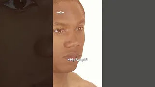 أغرب ما استخرجه الأطباء من بطون البشر 