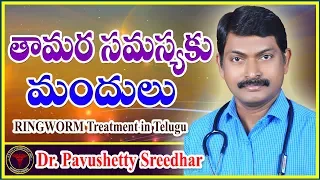 Download తామర సమస్య l RINGWORM Treatment in Telugu l Homeopathy l Dr. Pavushetty Sreedhar MP3