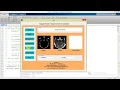 Image Fusion Using Curvelet Transform Matlab Project with Source Code