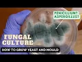 Fungal Culture Test Media