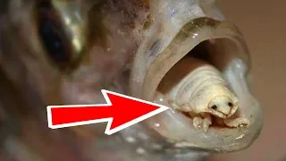 10 Real Parasites That Are Really Creepy