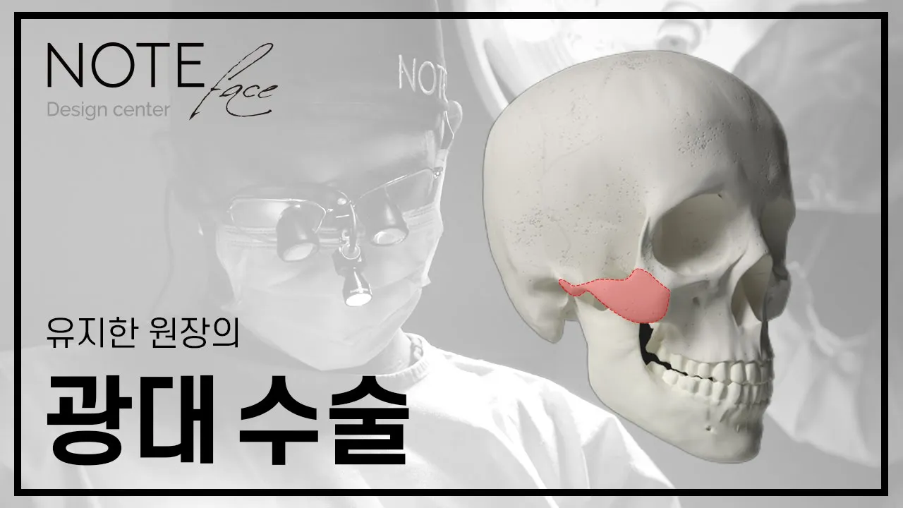 [노트성형외과] 안면윤곽_ 광대 축소술의 모든것