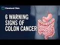 Download Lagu 6 Warning Signs of Colon Cancer