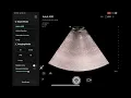 Mindray TE Air e5m Comprehensive Review from Peachtree POCUS