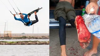 A Bloody End to the Kite Trip *WARNING* Blood & Gore