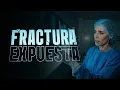 FRACTURA EXPUESTA EN VIVO con Mariana Brey
