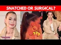 Anne Hathaway s New Look Sparks Plastic Surgery Speculation Tarnishing Her Natural Beauty Tag N18G