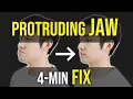 Protruding Jaw Underbite Fix Facial Asymmetry Correction Corrective Exercises