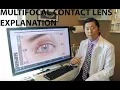 Healthy Eyes Optometry Multifocal Contact Lens Explanation