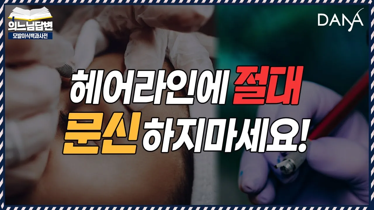 의느님답변📂헤어라인 반영구 문신 하지마세요!ㅣ충분한 상담과 진단 후 결정하세요👩🔬 ㅣ다나성형외과(DANA)ㅣ모발이식ㅣ헤어라인교정ㅣ두피문신ㅣ탈모치료