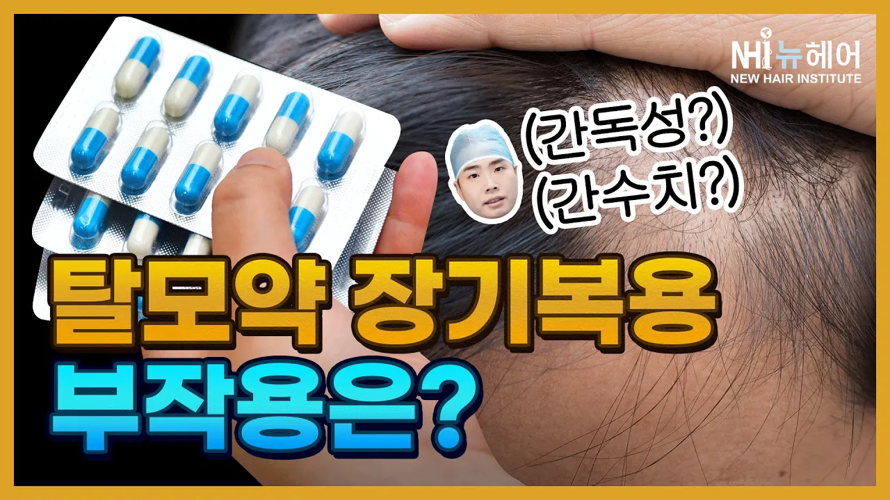 탈모약 장기복용 안전할까? l 간독성 l 뉴헤어 l 탈모치료
