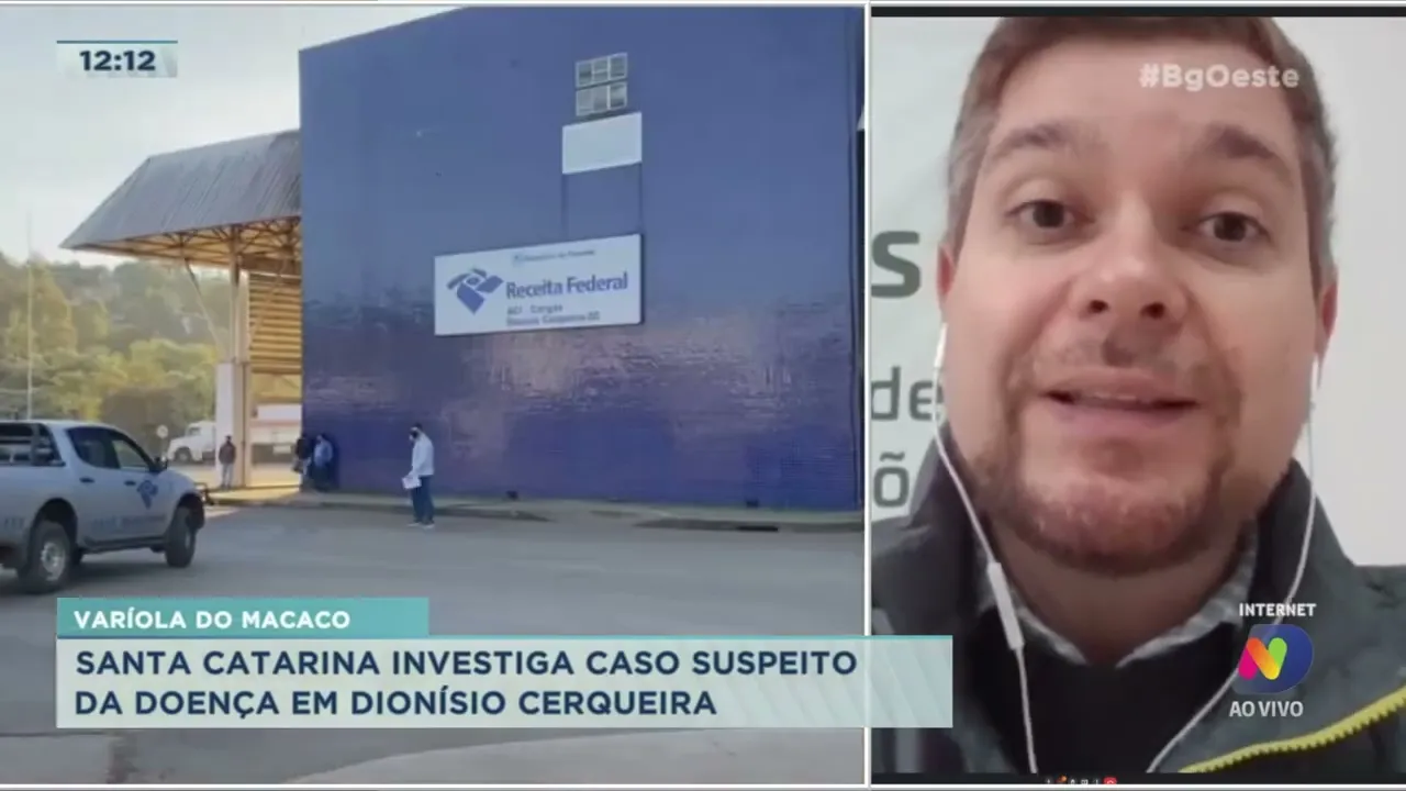 Santa Catarina investiga caso suspeito de Varíola do Macaco em Dionísio Cerqueira