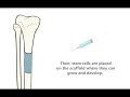 Bone Scaffolding