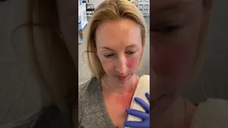 Platysma Exercise part 4