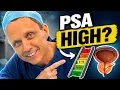 High PSA Don t Panic Follow This Roadmap