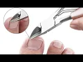 Amazing Ingrown Toenail Cutter -