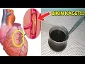 Download Lagu Bikin kaget!! Inilah 5 Manfaat minum kopi tanpa gula setiap hari || YtNetral