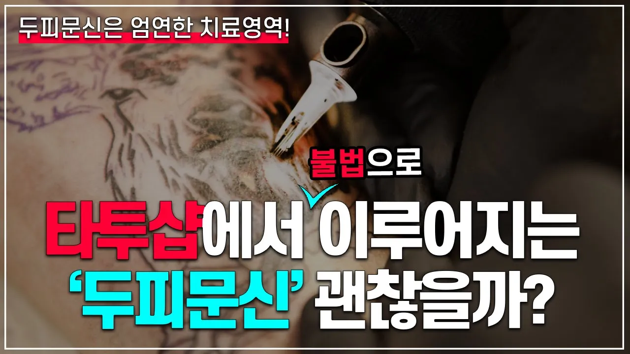 의느님답변📂ㅣ타투샵에서 이루어지는 두피문신은 모두 불법입니다.