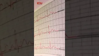 ICU Sound ECG Icu Icugyan Sound Ekg 