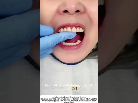 Dentist Fitting a Dental Crown – Precise Work for a Natural Smile 🦷👨‍⚕️